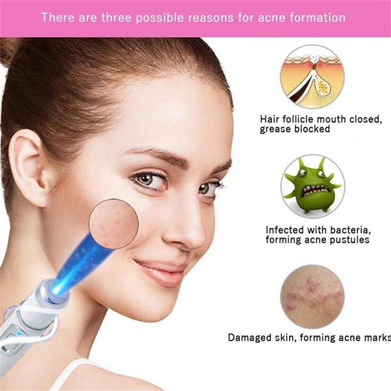 Acne Scar Wrinkle Removal Pen - fitople